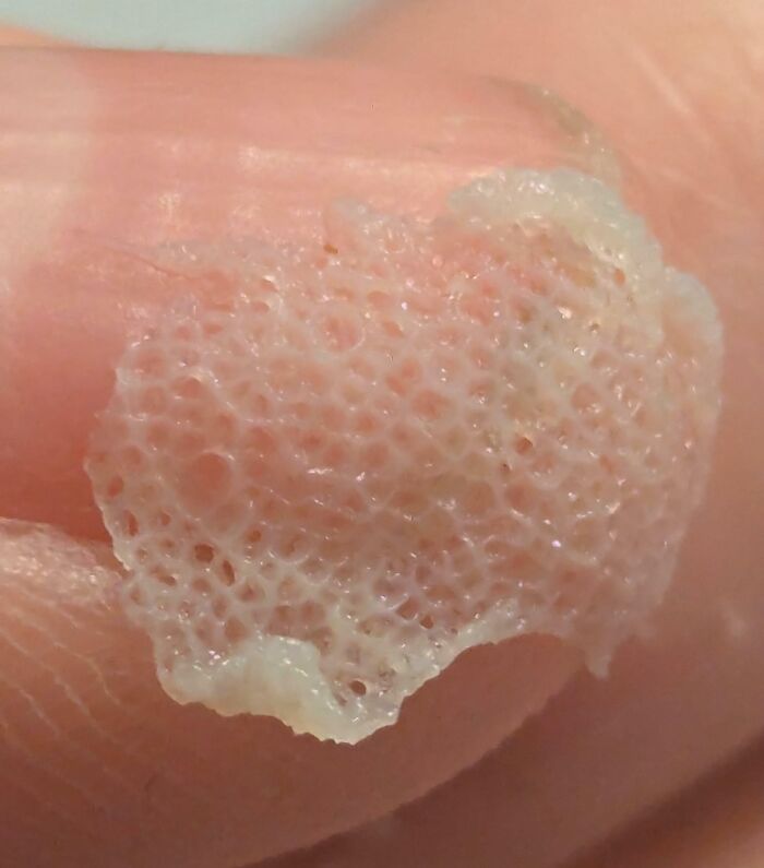 Wait, People Actually Shared These Wild Body Pics?! 61 Absolutely Mind-Blowing Shots