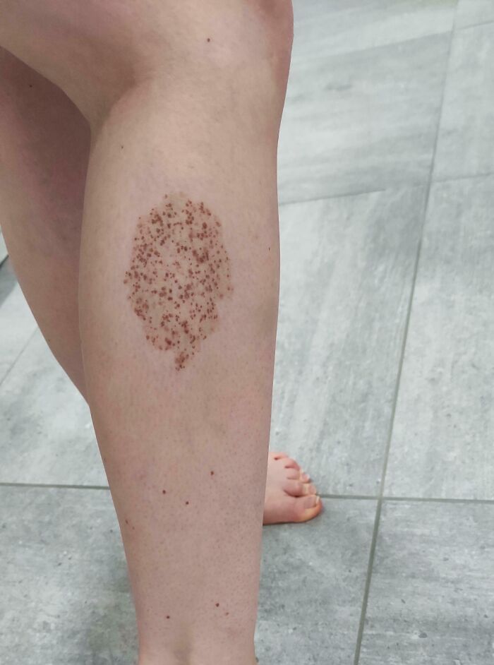 Wait, People Actually Shared These Wild Body Pics?! 61 Absolutely Mind-Blowing Shots
