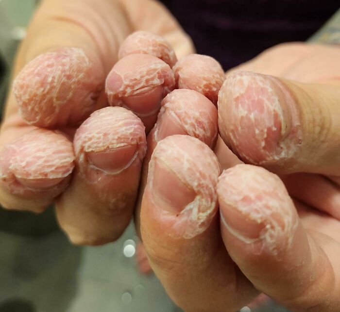 Wait, People Actually Shared These Wild Body Pics?! 61 Absolutely Mind-Blowing Shots