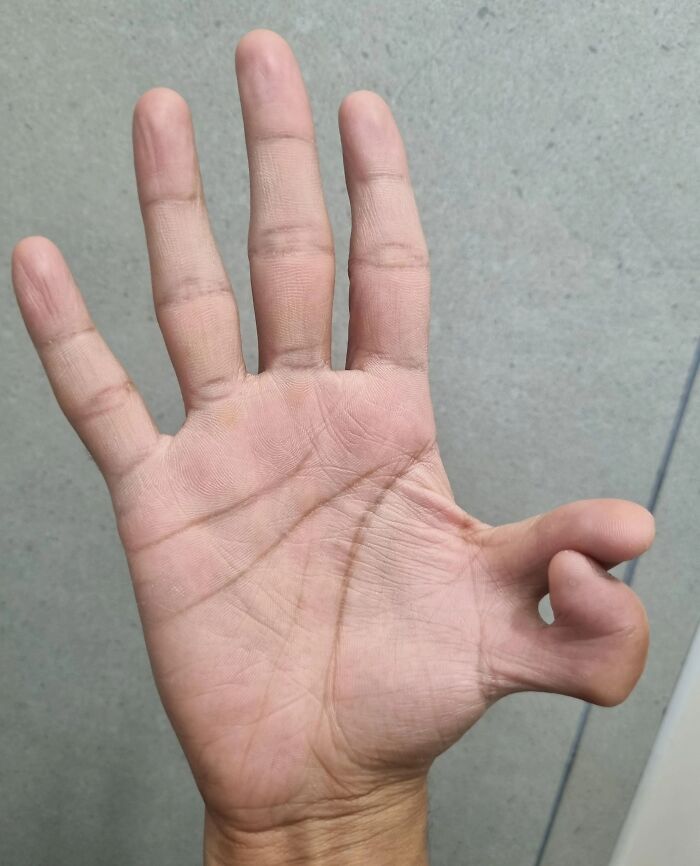Wait, People Actually Shared These Wild Body Pics?! 61 Absolutely Mind-Blowing Shots