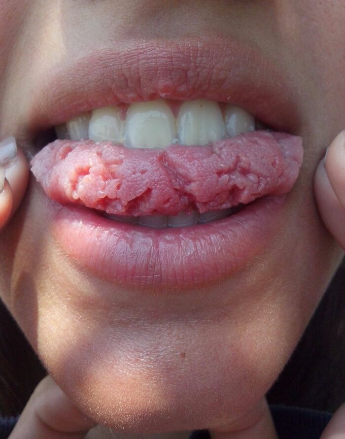 Wait, People Actually Shared These Wild Body Pics?! 61 Absolutely Mind-Blowing Shots