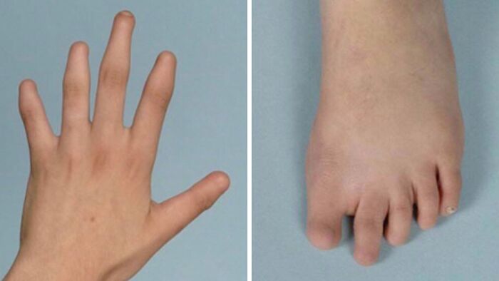 Wait, People Actually Shared These Wild Body Pics?! 61 Absolutely Mind-Blowing Shots