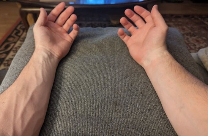 Wait, People Actually Shared These Wild Body Pics?! 61 Absolutely Mind-Blowing Shots