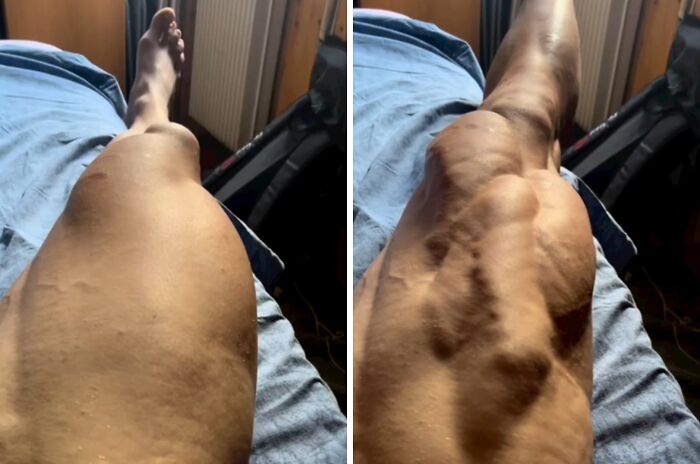 Wait, People Actually Shared These Wild Body Pics?! 61 Absolutely Mind-Blowing Shots