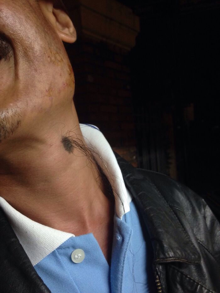 Wait, People Actually Shared These Wild Body Pics?! 61 Absolutely Mind-Blowing Shots