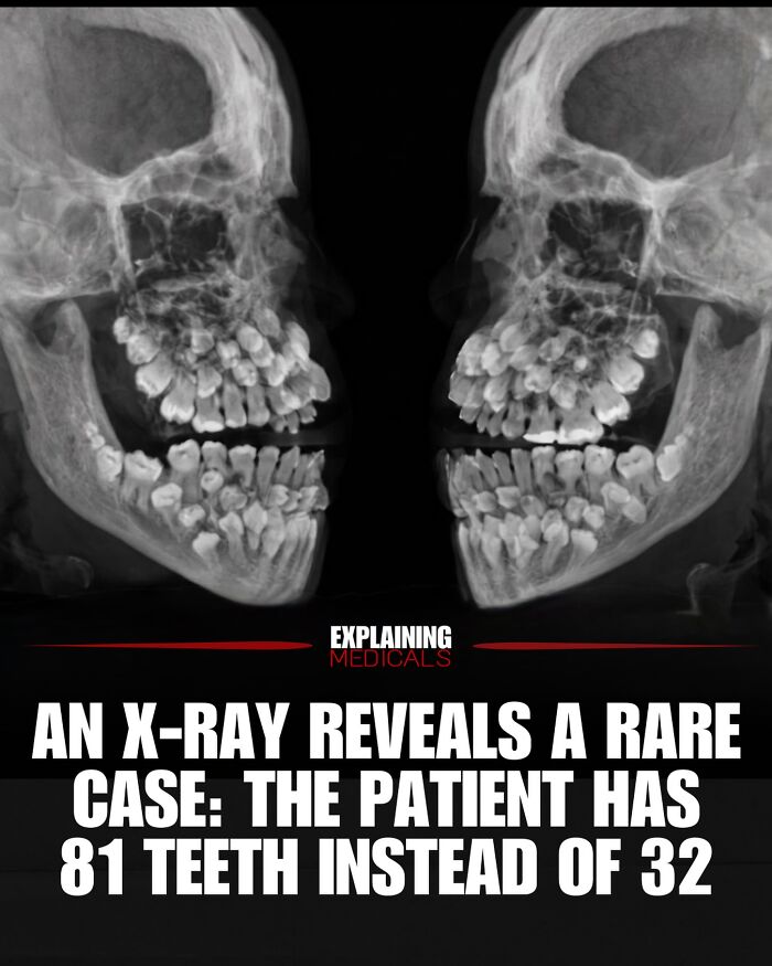 61 Medical Facts That Are Actually Pretty Awesome