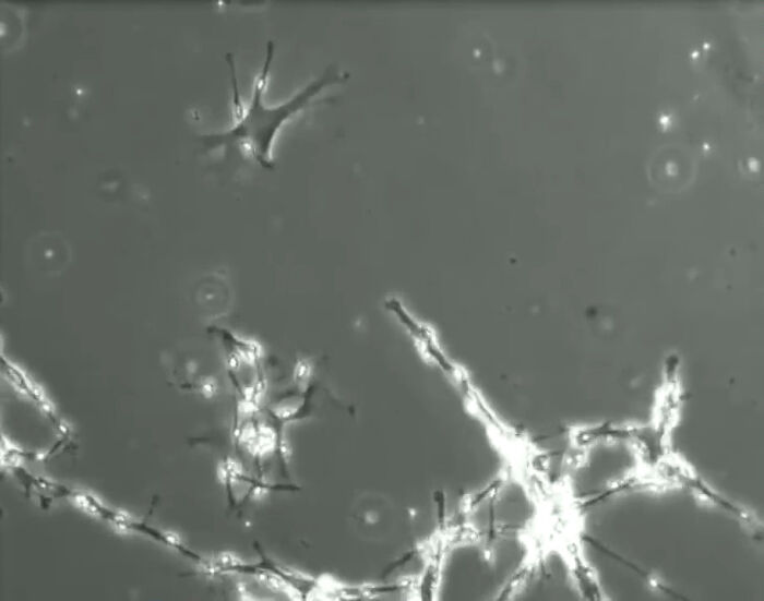 Neurons Networking: The Tiny Brain Bunch Making Memories And Dreams