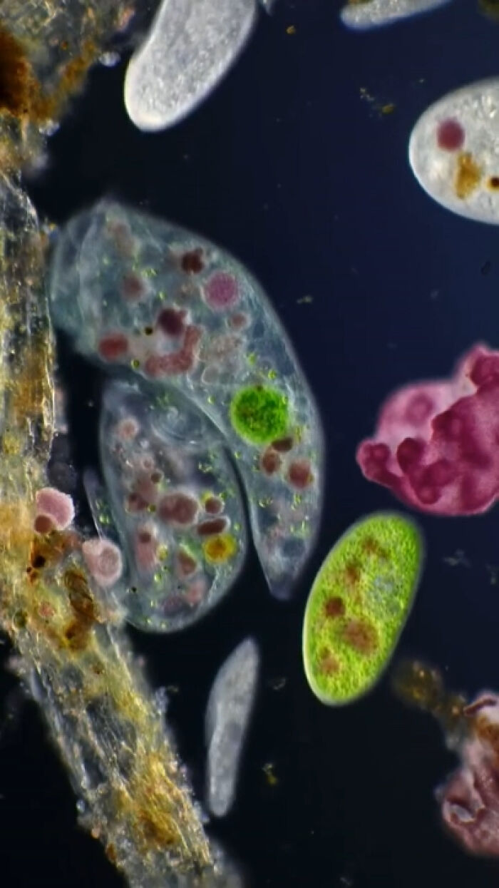 Sample From A Tiny Forest Pond—Tiny Worlds, Big Wonders