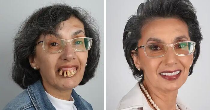 Crazy Smile Makeovers That Will Totally Surprise You