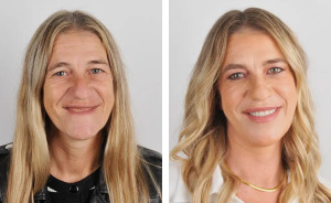 Crazy Smile Makeovers That Will Totally Surprise You