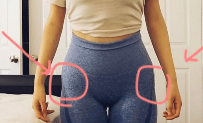 Hip Dips Aren’t A Flaw You Can Just ‘Fix’ With Exercise