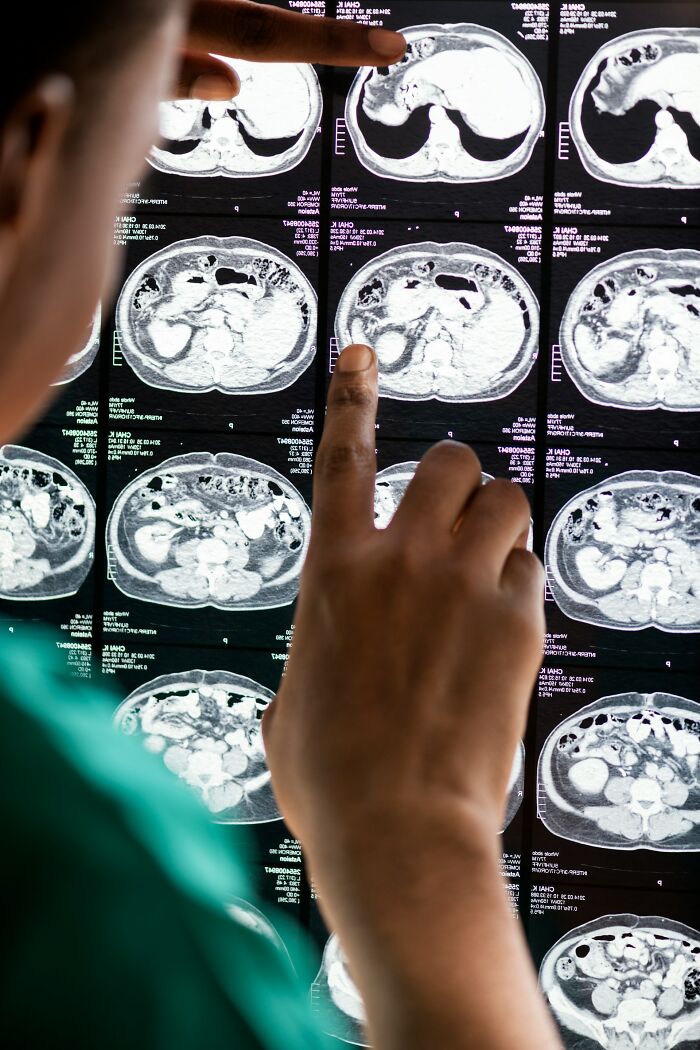 Wait, The Human Body Does WHAT? 38 Wild Facts That Will Totally Freak You Out