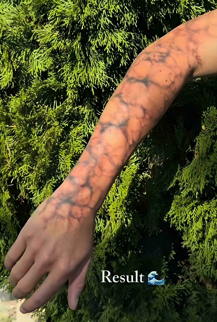 Ocean Tattoo or Medical Mystery?