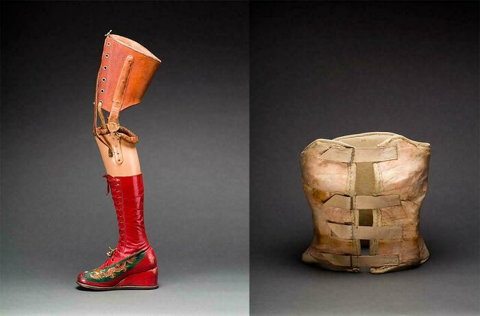 Frida Kahlo’s Prosthesis And Corset — Art Meets Medicine