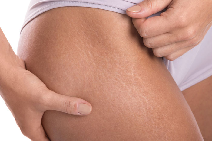 The Wildest Body Comments Women Didn't See Coming