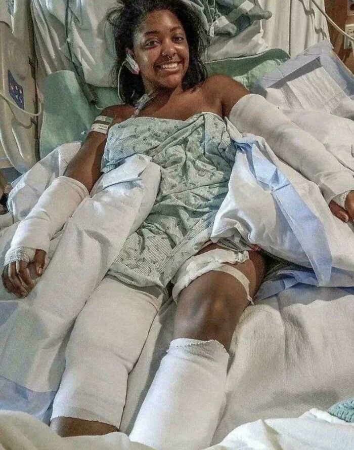 She Took 40 Bites to Save a Baby’s Life!