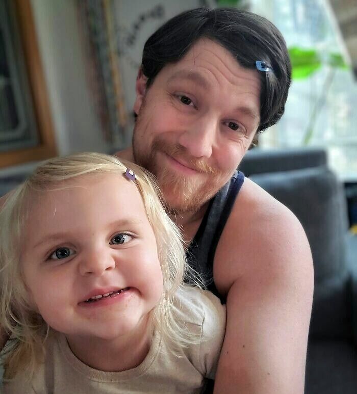 Dad Faces Down Daughter’s Bobby Pin Fear, One Pin At A Time