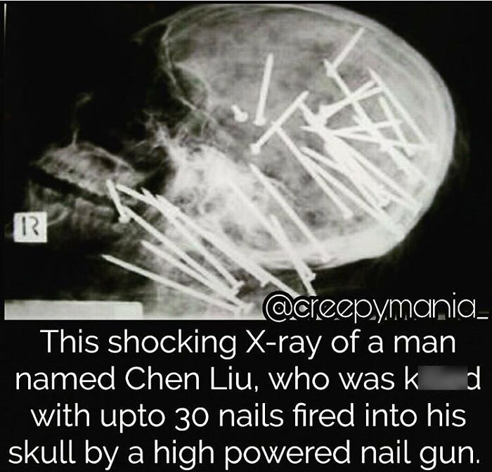 Wait, They Actually Shared These Creepy Stories?!