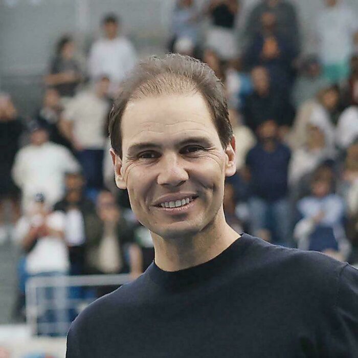 Rafael Nadal’s Hair: Ace or Fault?