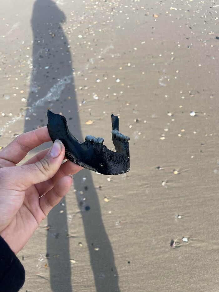 Found This on an Irish Beach—Human Jaw? Eek!