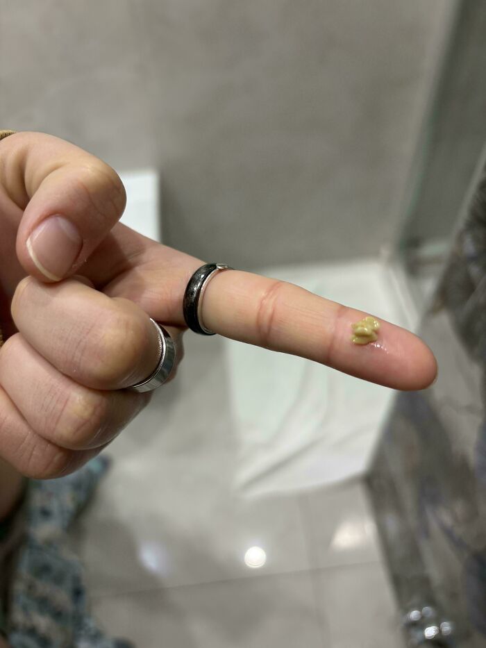 Oops! People Touched the Stuff They Definitely Shouldn't Have
