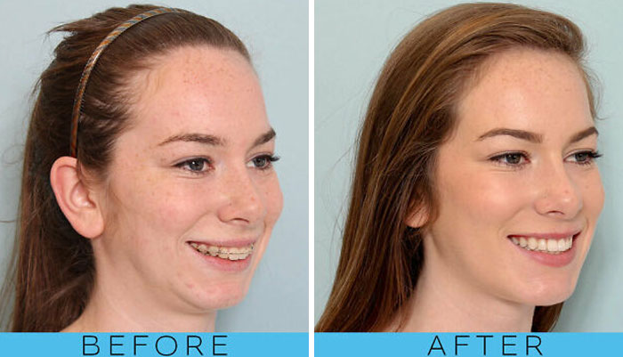 Wait Till You See These 65 Glow Ups That Are Totally Jaw-Dropping