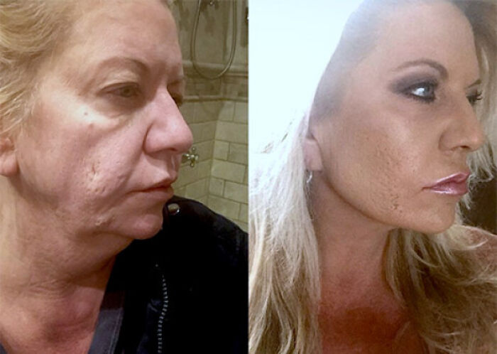 Wait Till You See These 65 Glow Ups That Are Totally Jaw-Dropping