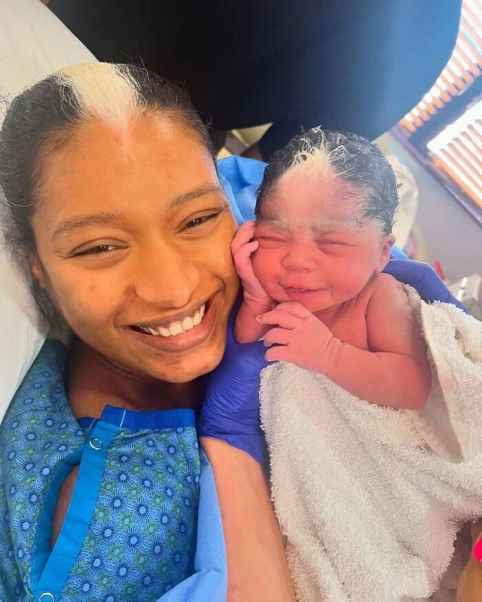 Mother And Newborn Share Rare White Hair Streak And Stun Everyone
