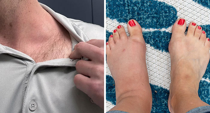 The Wildest Medical Symptoms People Totally Ignore (And Probably Shouldn’t)