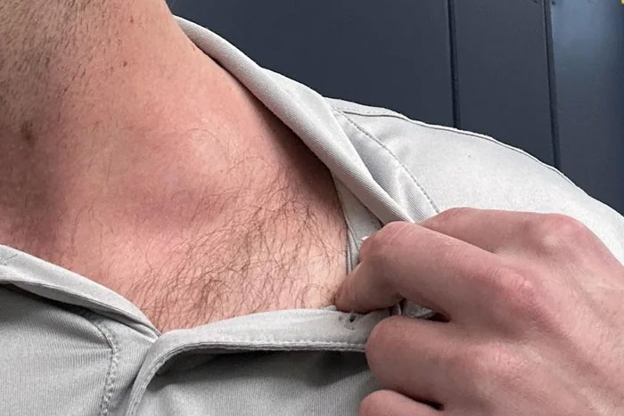 The Wildest Medical Symptoms People Totally Ignore (And Probably Shouldn't)