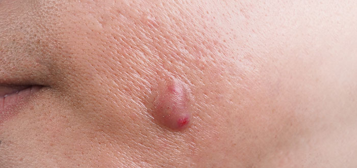 The Wildest Medical Symptoms People Totally Ignore (And Probably Shouldn't)