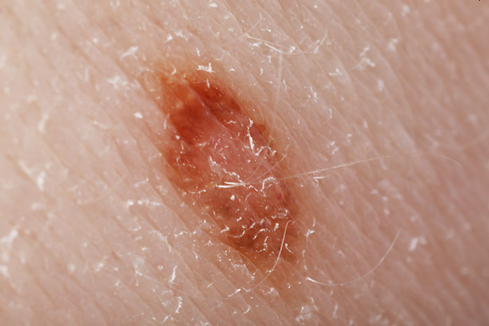 The Wildest Medical Symptoms People Totally Ignore (And Probably Shouldn't)