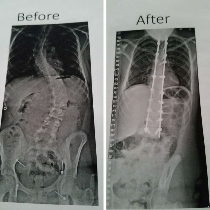 40+ Before-And-After Pics That Guess What? Actually Change A Lot!