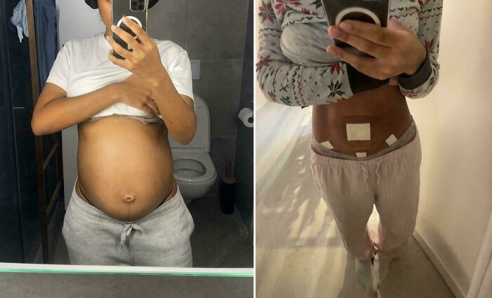 40+ Before-And-After Pics That Guess What? Actually Change A Lot!