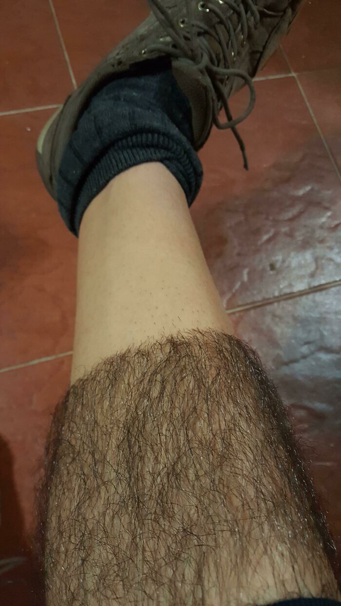 40+ Before-And-After Pics That Guess What? Actually Change A Lot!