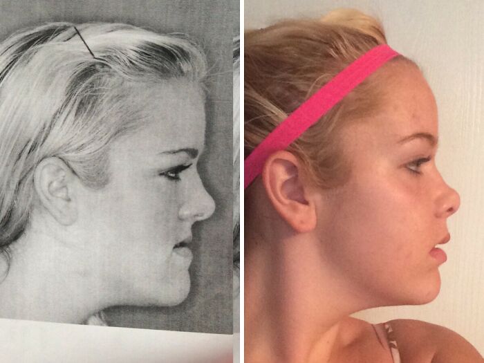 40+ Before-And-After Pics That Guess What? Actually Change A Lot!
