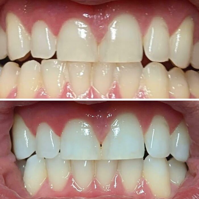 40+ Before-And-After Pics That Guess What? Actually Change A Lot!