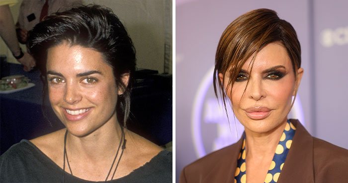 15 Celebs Who Just Couldn’t Stop with the Plastic Surgeries (And Yikes, It Shows!)