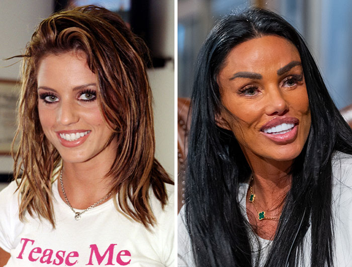 Katie Price’s Plastic Surgery Shopping Spree
