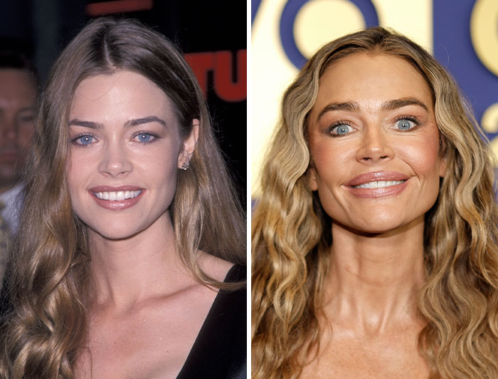Denise Richards Finally Facelifts the Look