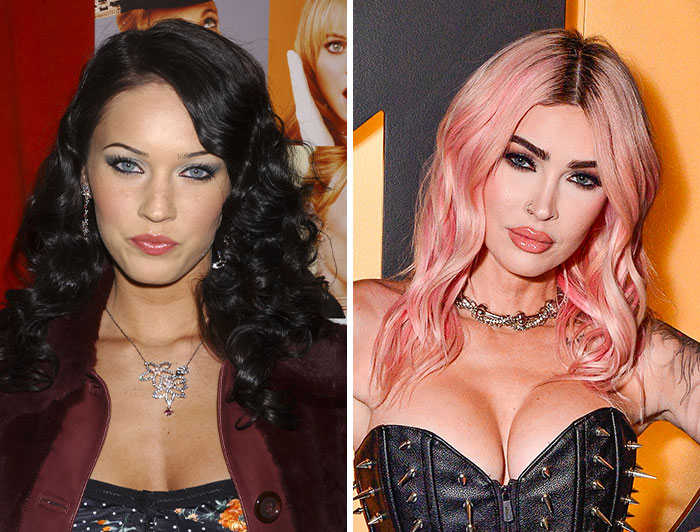 Megan Fox’s Surgery Secrets