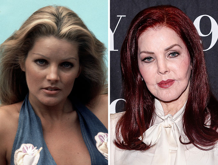 Priscilla Presley’s Silicone Scandal