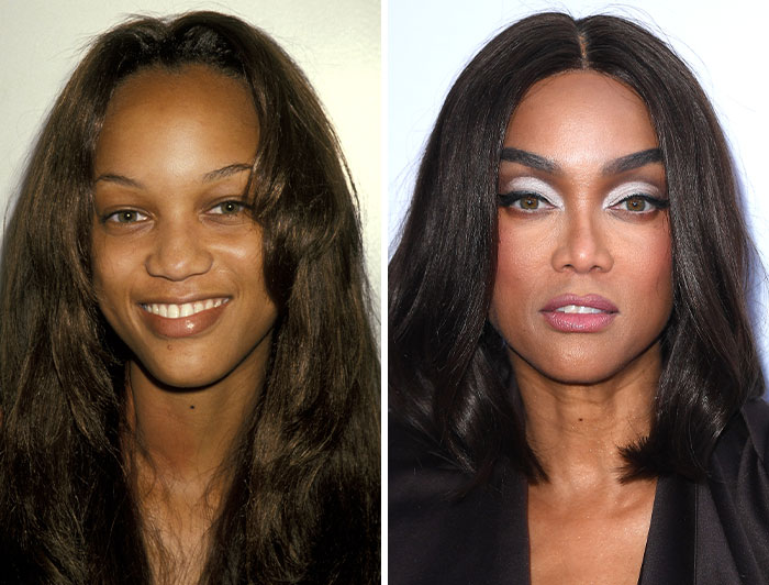 Tyra Banks: The No-Drama Botox Queen