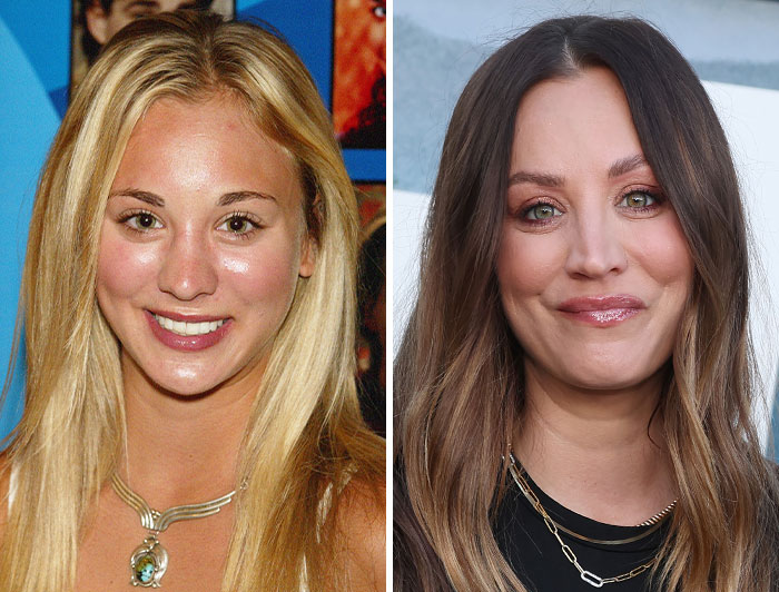 Kaley Cuoco: Botox Wake-Up Call