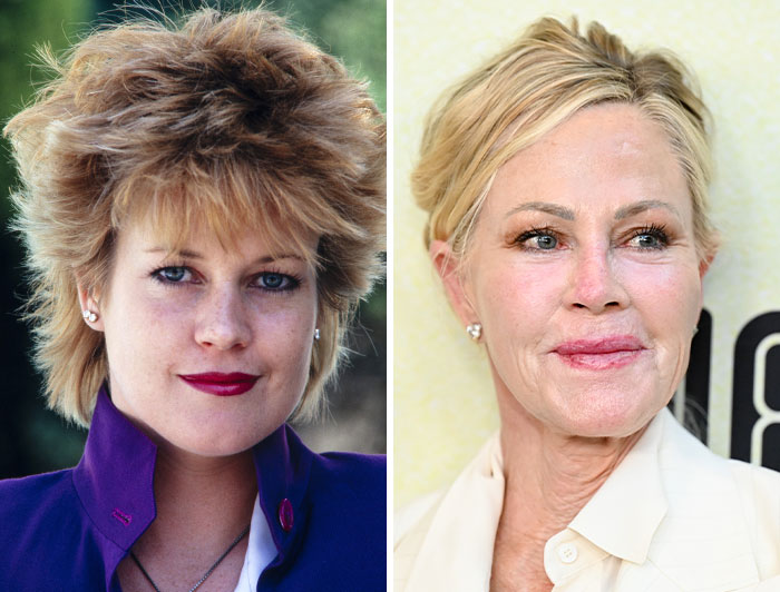Melanie Griffith’s Plastic Surgery Rollercoaster