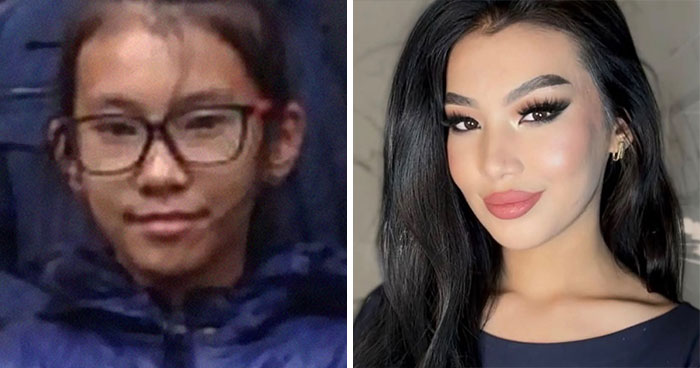 Wait Till You See These Epic ‘Ugly Duckling’ Glow-Ups!