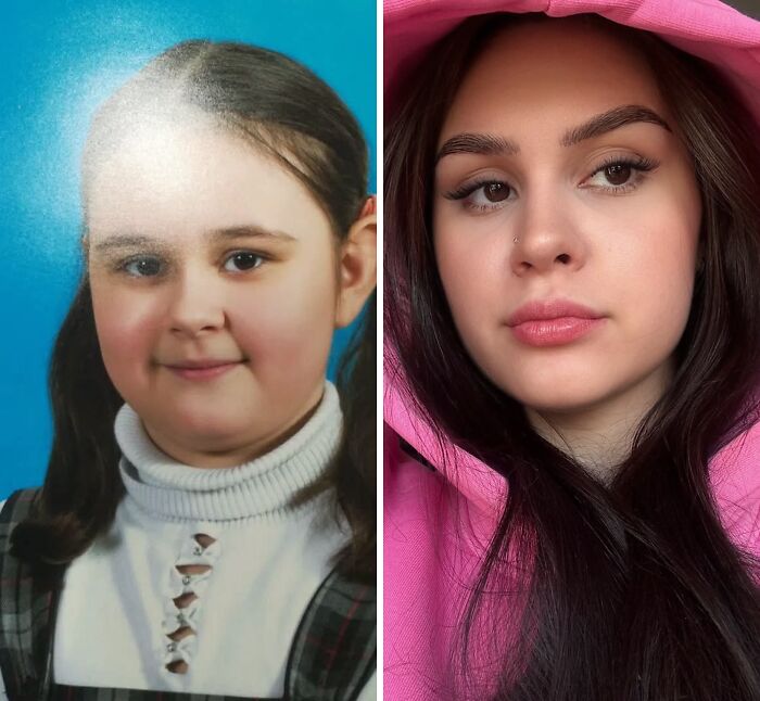 Wait Till You See These Epic ‘Ugly Duckling’ Glow-Ups!