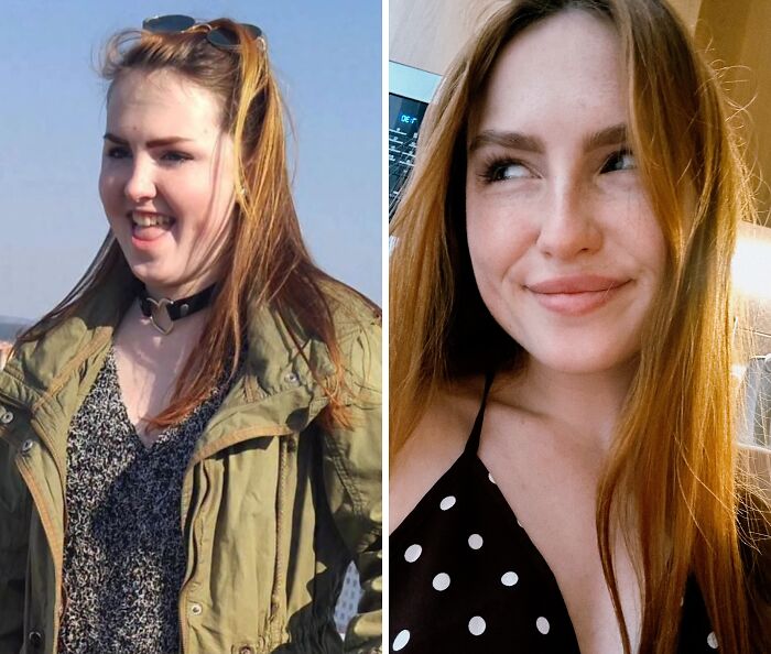 Wait Till You See These Epic ‘Ugly Duckling’ Glow-Ups!