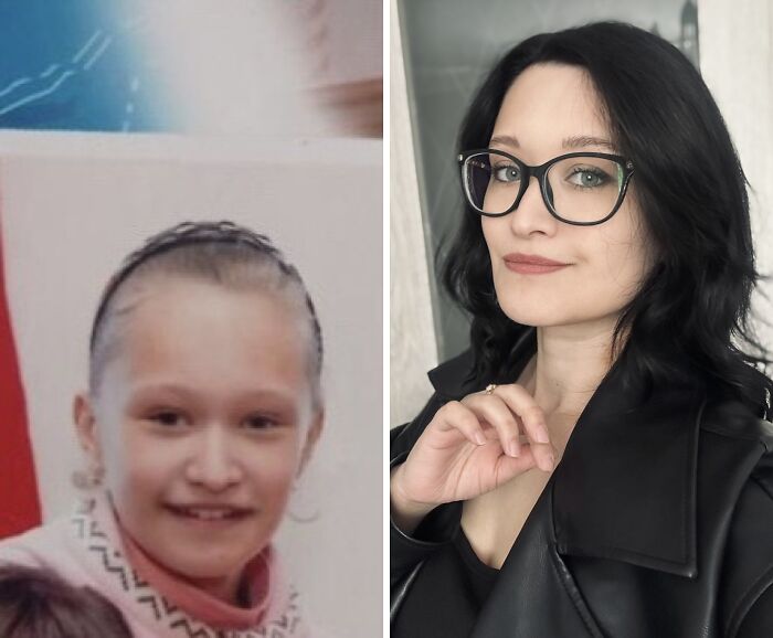 Wait Till You See These Epic ‘Ugly Duckling’ Glow-Ups!