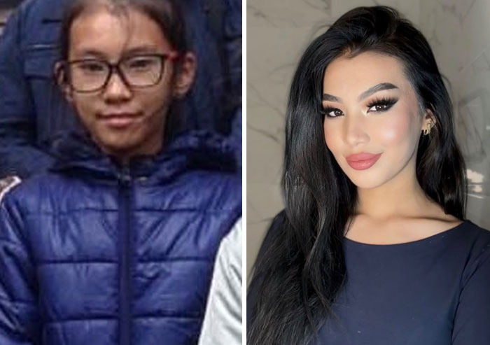 Wait Till You See These Epic ‘Ugly Duckling’ Glow-Ups!